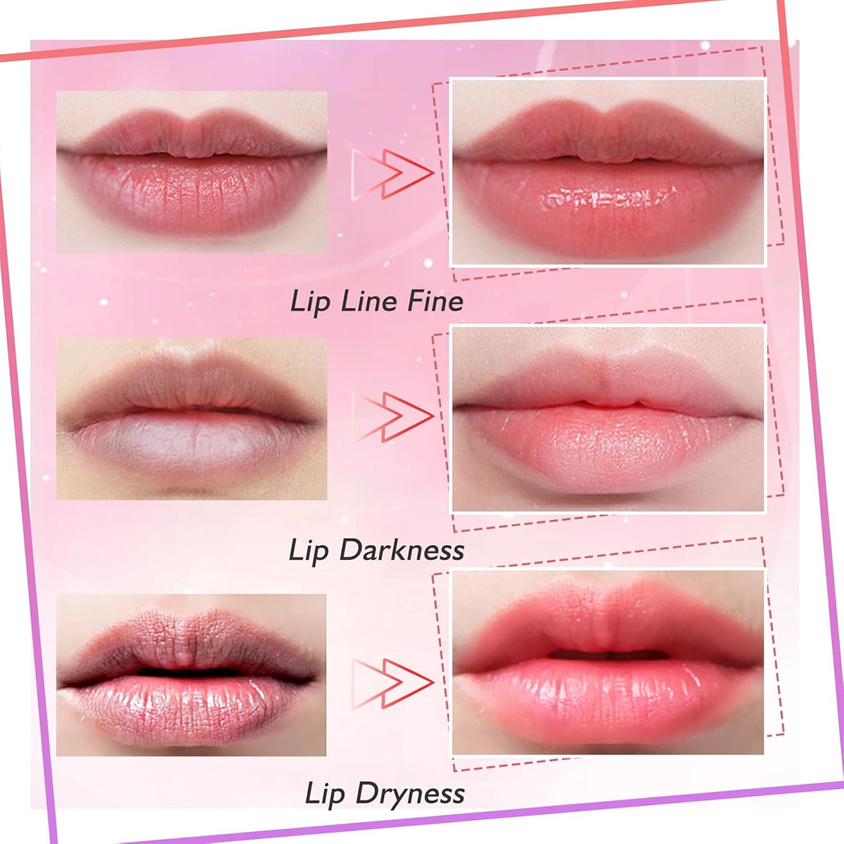 Lip Patches 5 Pcs Per Box